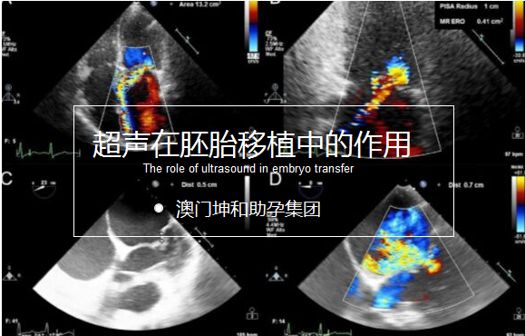 超声在胚胎移植中的作用