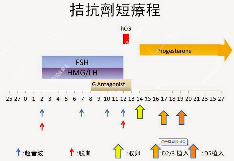 GnRH拮抗剂方案促排卵的新进展