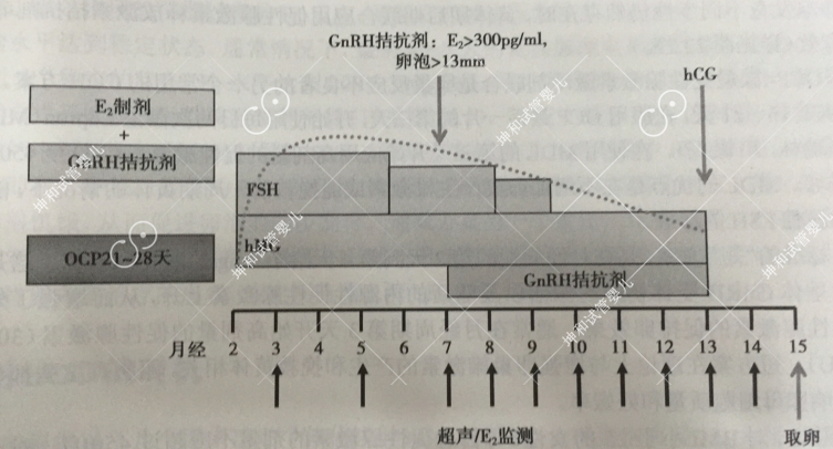 促排卵方案