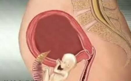 上海第三代试管：慢性盆腔炎可以试管婴儿吗？