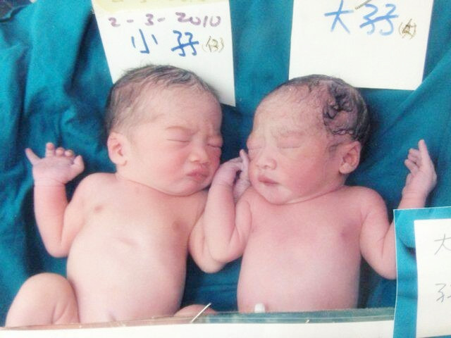 澳门试管婴儿网：试管婴儿长大后有弊端吗