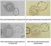 试管婴儿成功率 坤和专家讲述养囊胚重要性
