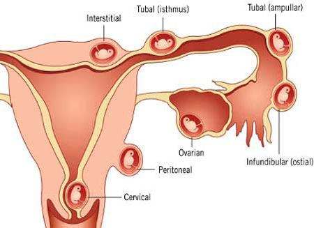 为什么说黄体期促排卵是卵巢功能不好患者的福音