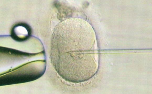 胚胎植入前遗传学检测