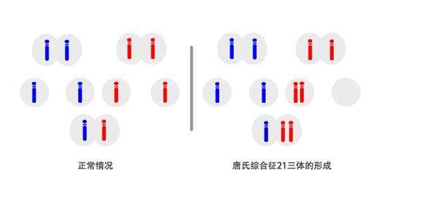 什么是染色体病,需要做胚胎植入前遗传学筛查吗