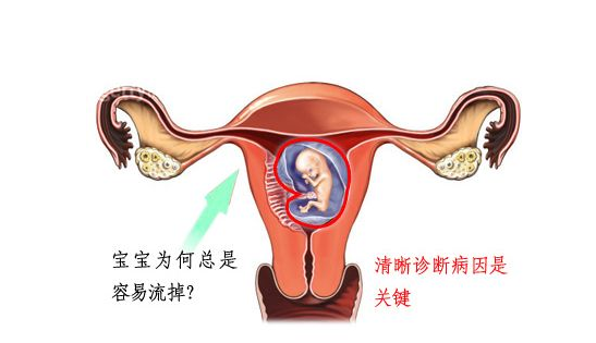 什么叫习惯性流产？第三代试管婴儿如何预防