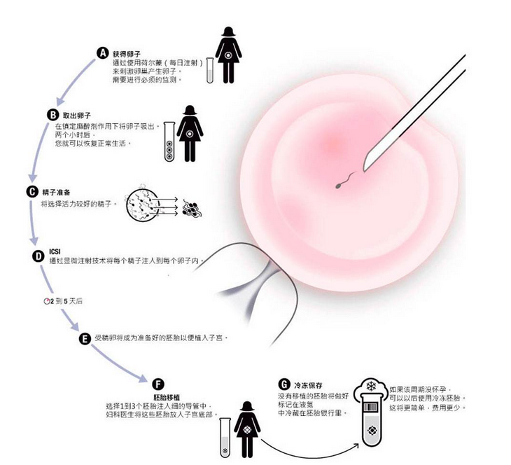 精卵质量差怎么保障试管婴儿成功率