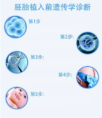 胚胎植入前遗传学诊断