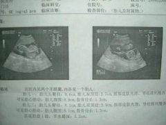 老夫少妻，在广州坤和做试管婴儿成功好孕