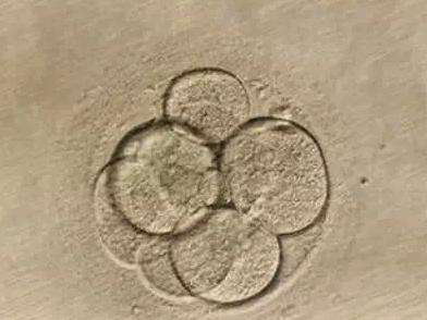 关于试管婴儿囊胚培育你需要弄懂这4条 
