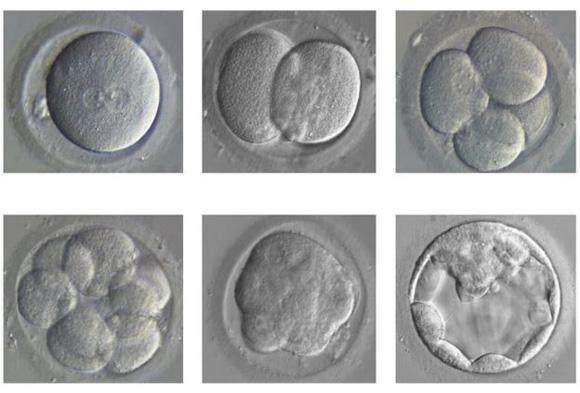 试管婴儿胚胎为什么囊胚移植比较好