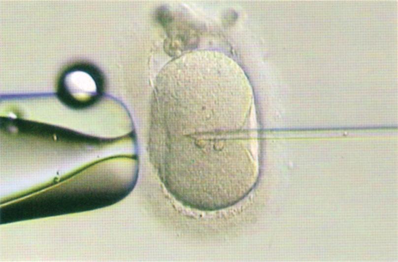 广州第二代试管婴儿：单精子注射技术