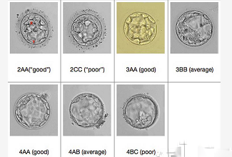 试管婴儿的胚胎等级跟成功率有什么关系