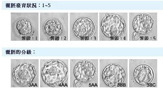 做试管婴儿怎样才能养成A级囊胚