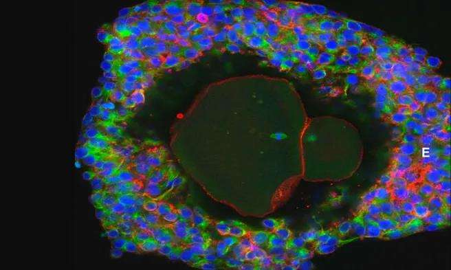 辅助生殖技术新发展 人类卵子首次在实验室培养成熟