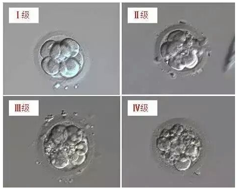 澳门试管婴儿专家解答：优质胚胎有哪些标准