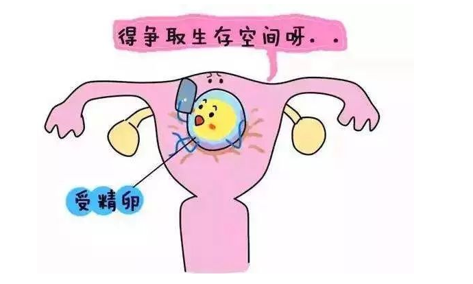 宫腔粘连介绍 适合试管婴儿吗