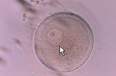 实验室详解试管婴儿胚胎发育全过程