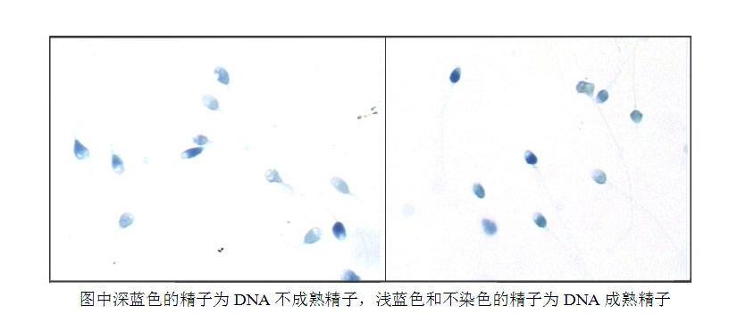 澳门坤和助孕中心专家详解：精子成熟度的检查