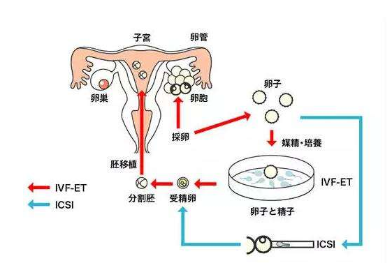 澳门试管婴儿移植最常见问题汇总