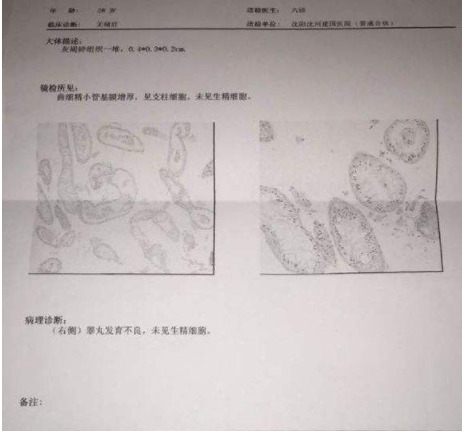 试管婴儿第三代技术中胚胎活检方法的选择