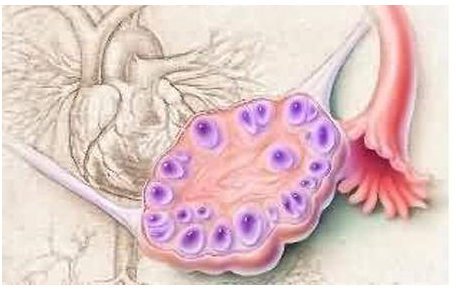 卵巢畸形胎瘤可以怀孕吗？如何做上海试管婴儿？