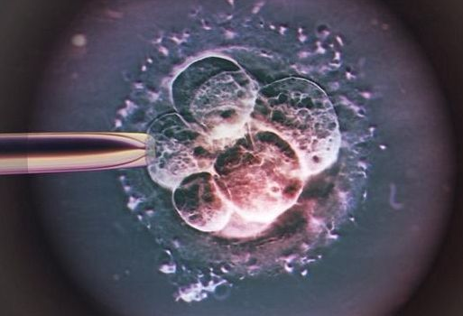 第三代试管婴儿遗传学检测在胚胎上的运用