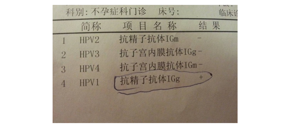 抗精子抗体对做上海试管婴儿有影响吗