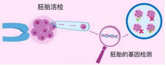 试管助孕机构：做美国试管婴儿痛苦大吗