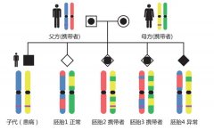 SNP全基因组胚胎植入前遗传学诊断