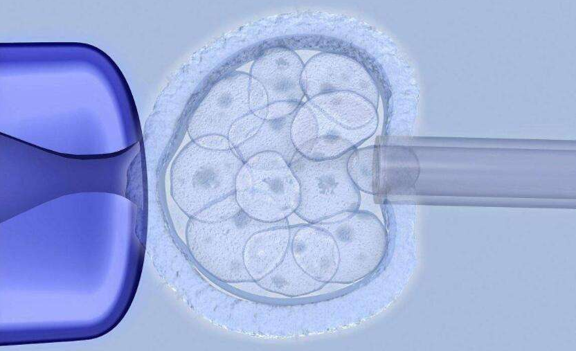 囊性纤维化遗传病及胚胎植入前遗传学诊断PGD