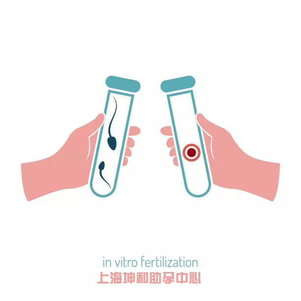 上海去美国哪个城市做试管婴儿好