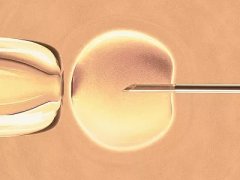 助孕官网:美国试管婴儿的移植成功率分析？哪家美国生殖诊所排名靠前
