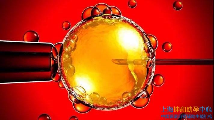 捐卵试管助孕：在上海怎么选择美国试管婴儿医院