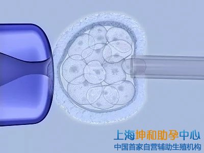 上海三大助孕公司：上海三代试管生男孩女孩哪个多？