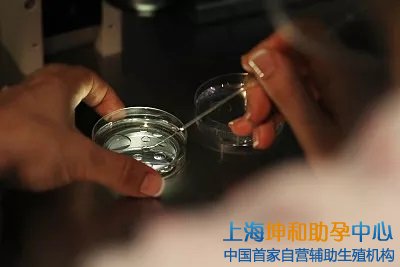 上海试管供卵助孕机构：上海助孕志愿者