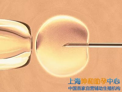 试管供卵助孕机构包成功：上海试管婴儿助孕的成功率是多少？