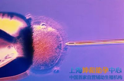 试管供卵助孕机构包成功：上海的助孕中心有哪些呢？