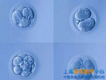 国内g_试管婴儿医院;上海试管婴儿胚胎分级标准