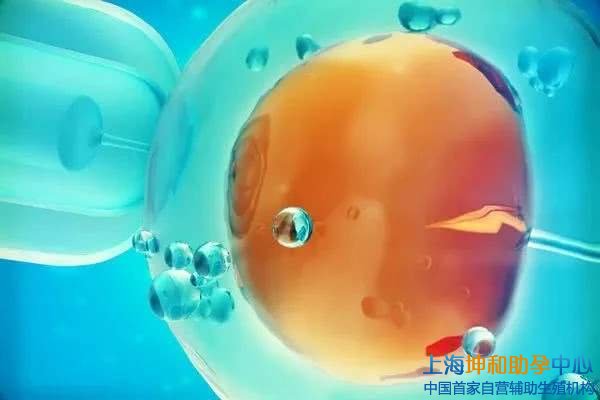 上海供卵：上海助孕哪家医院最好