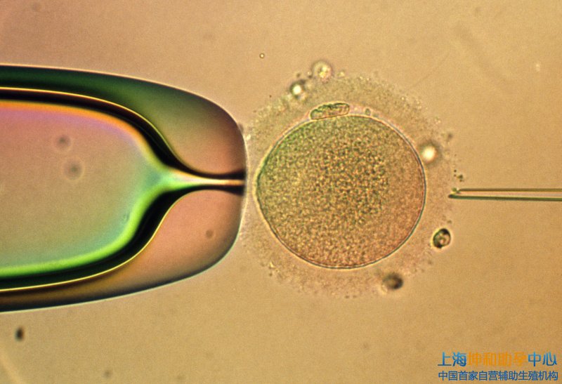 上海助孕机构：上海三代试管囊胚是怎样挑选的？