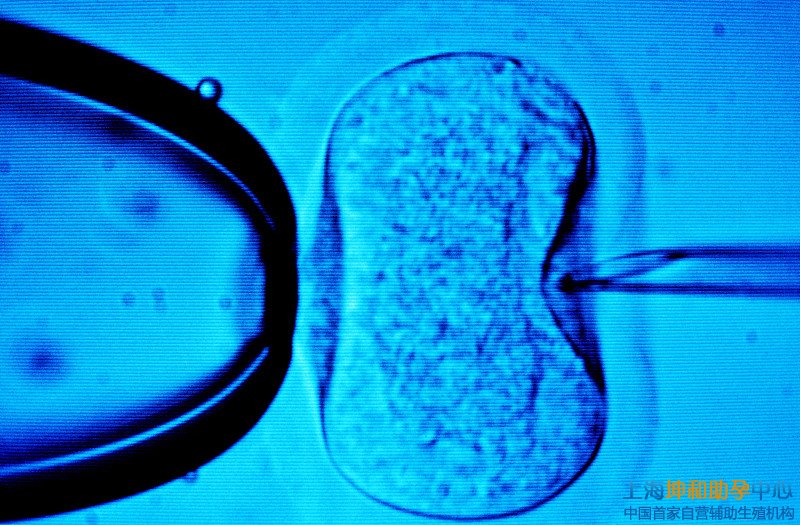 上海助孕公司_上海试管婴儿移植后几天可以测出来