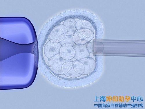上海坤和助孕中心
