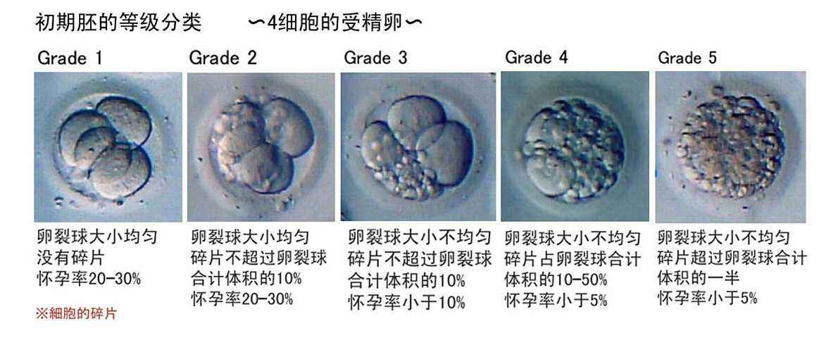 专家讲解：试管婴儿一定需要囊胚移植吗