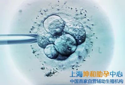 正规试管供卵助孕代生机构
